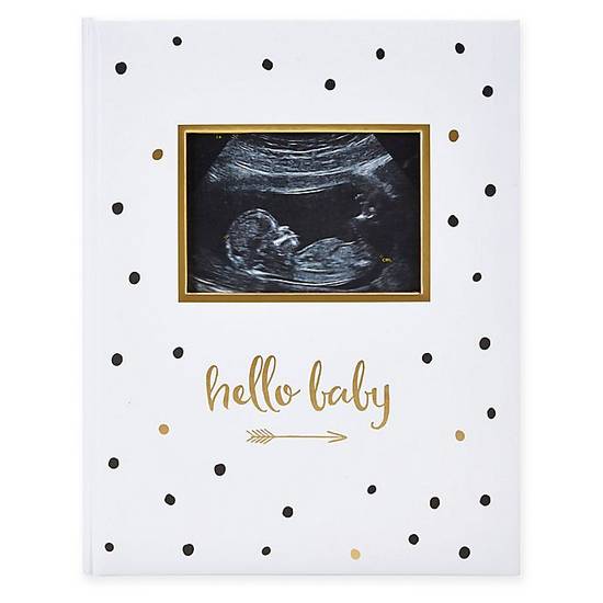 Order Pearhead® "Hello Baby" Sonogram Baby Memory Book, Black and Gold Polka Dots food online from Bed Bath & Beyond store, Henrietta on bringmethat.com